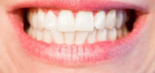 dokonale bílé zuby
